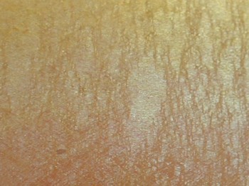 : item #2, image 10